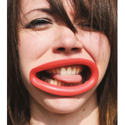 Prothèse hyperlip lèvres sourire